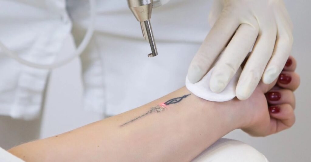 How To Prepare For The Tattoo Procedure