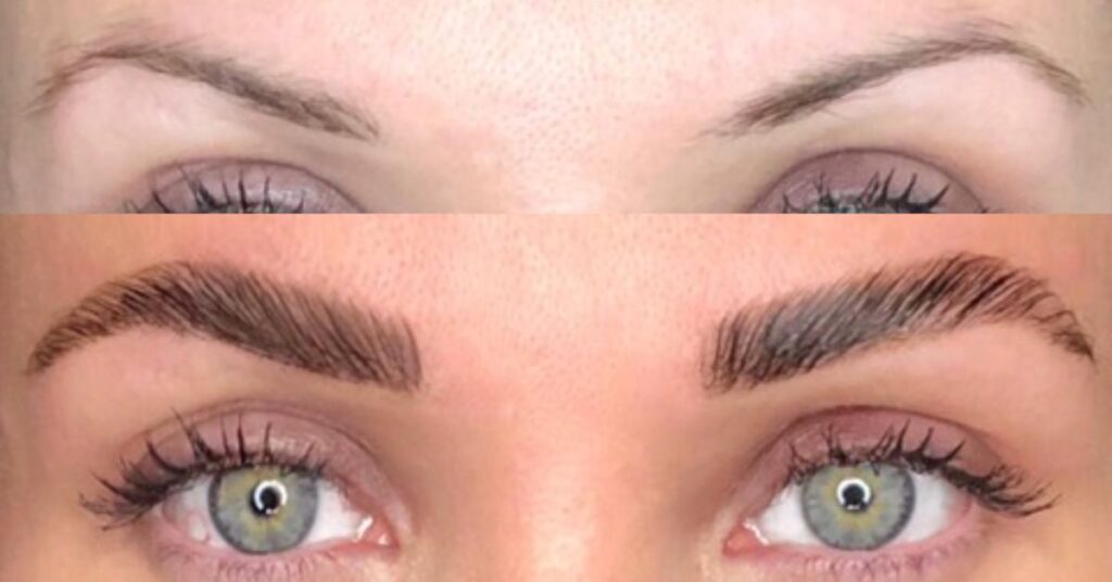 What Are the Results of Brow Lamination on Thin Brows