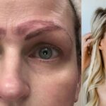 Fixing Microblading Gone Wrong Quick Solutions for Bad Eyebrows
