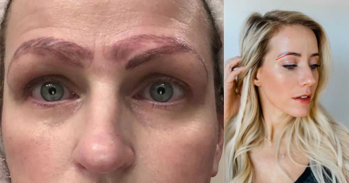 Fixing Microblading Gone Wrong Quick Solutions for Bad Eyebrows